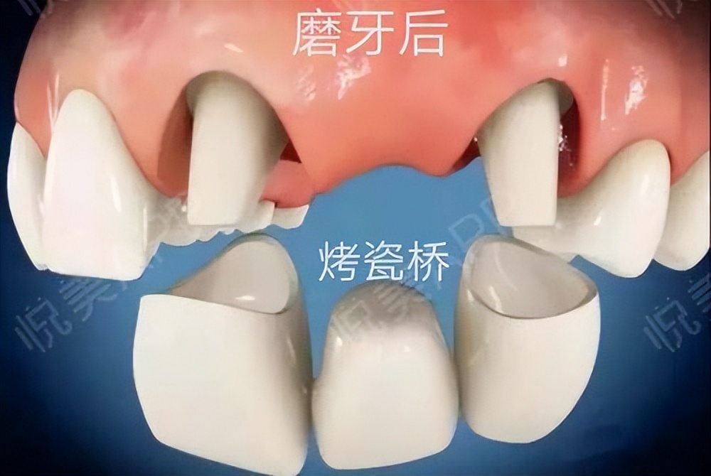 瘦到脸部凹陷到底好不好看,瘦到五官凹陷
