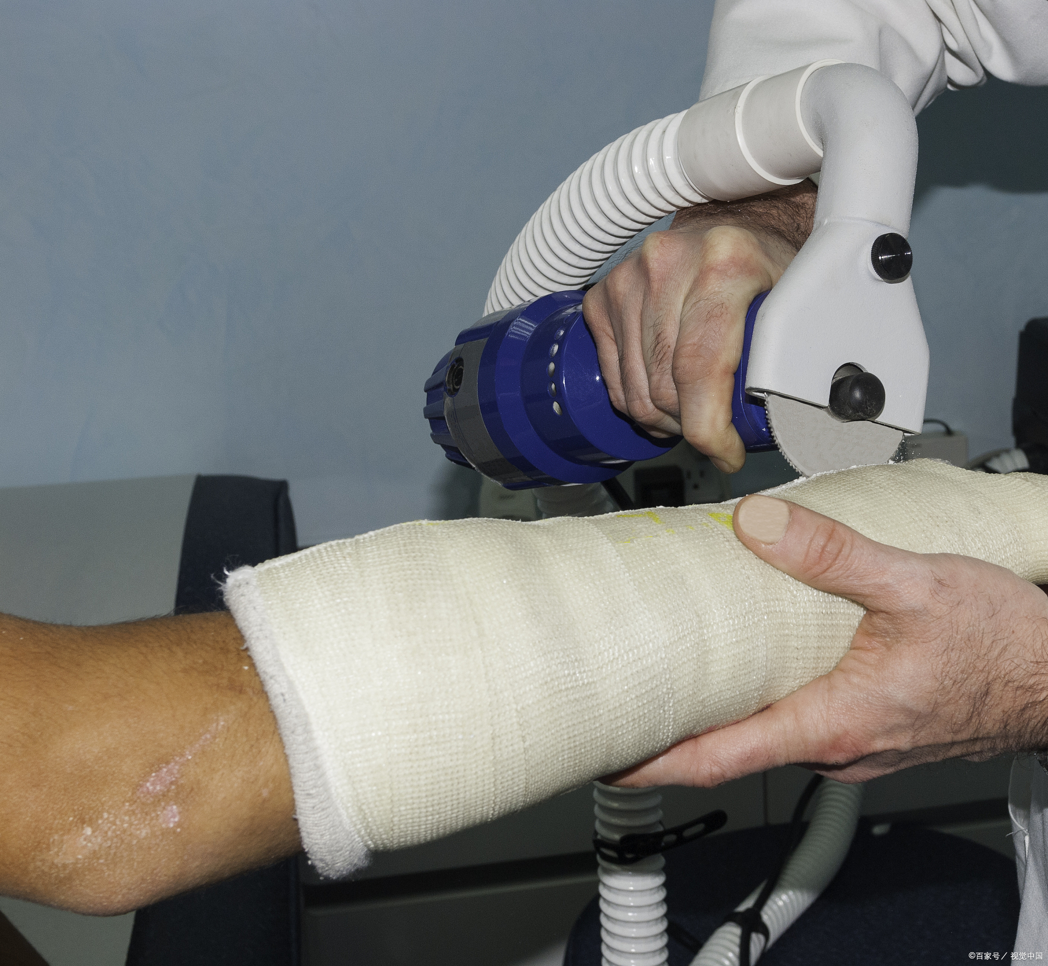 骨折病人康复训练的原则,骨折康复训练最好的方法