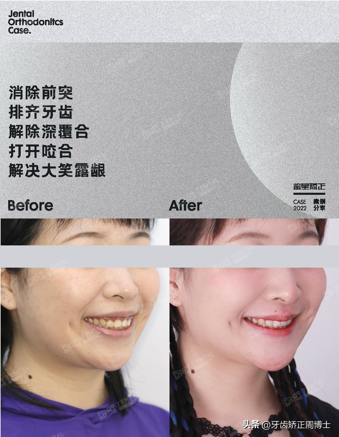 <html>
<head><title>502BadGateway</title></head>
<body>
<center><h1>502BadGateway</h1></center>
<hr><center>nginx</center>
</body>
</html>
<!--apaddingtodisableMSIEandChromefriendlyerrorpage-->
<!--apaddingtodisableMSIEandChromefriendlyerrorpage-->
<!--apaddingtodisableMSIEandChromefriendlyerrorpage-->
<!--apaddingtodisableMSIEandChromefriendlyerrorpage-->
<!--apaddingtodisableMSIEandChromefriendlyerrorpage-->
<!--apaddingtodisableMSIEandChromefriendlyerrorpage-->
