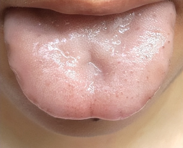 气血不足的十大症状表现怎么治疗,列举六个气血不足的症状表现