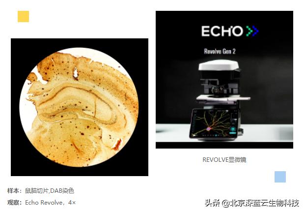 生物显微镜玻片的制作,显微镜玻片制作方法