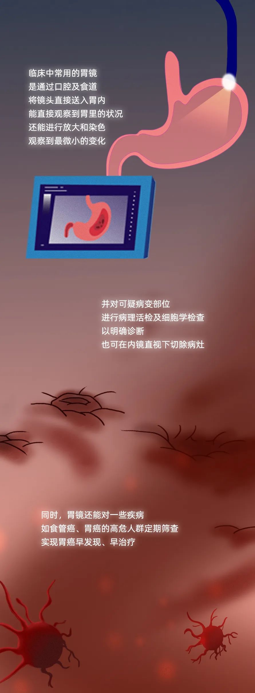 胃镜检查全过程演示，看完你还会怕吗？