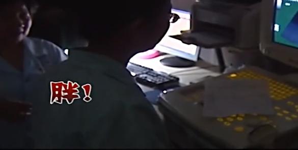 上海农妇怀胎四年,上海农妇怀胎四年未生全集