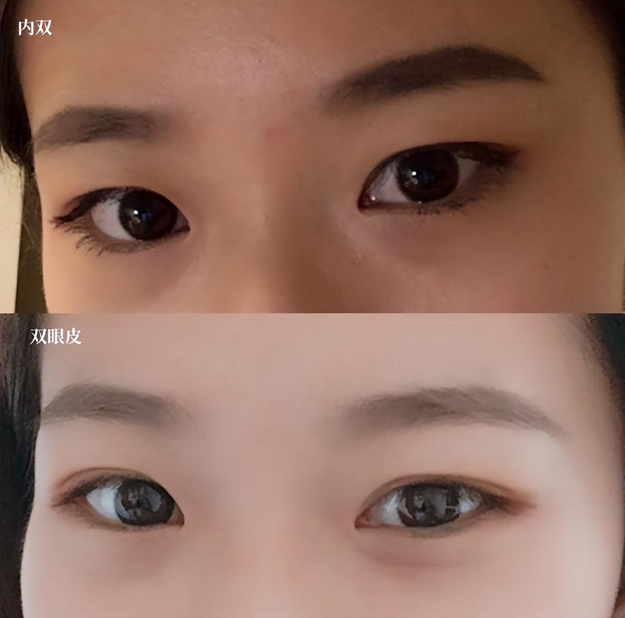 怎么判断什么样的双眼皮适合自己,如何辨别自己是单眼皮还是双眼皮
