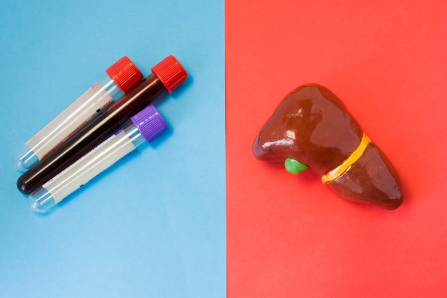 乙肝大三阳怎么降低传染性,乙肝大三阳怎么治疗能转小三阳