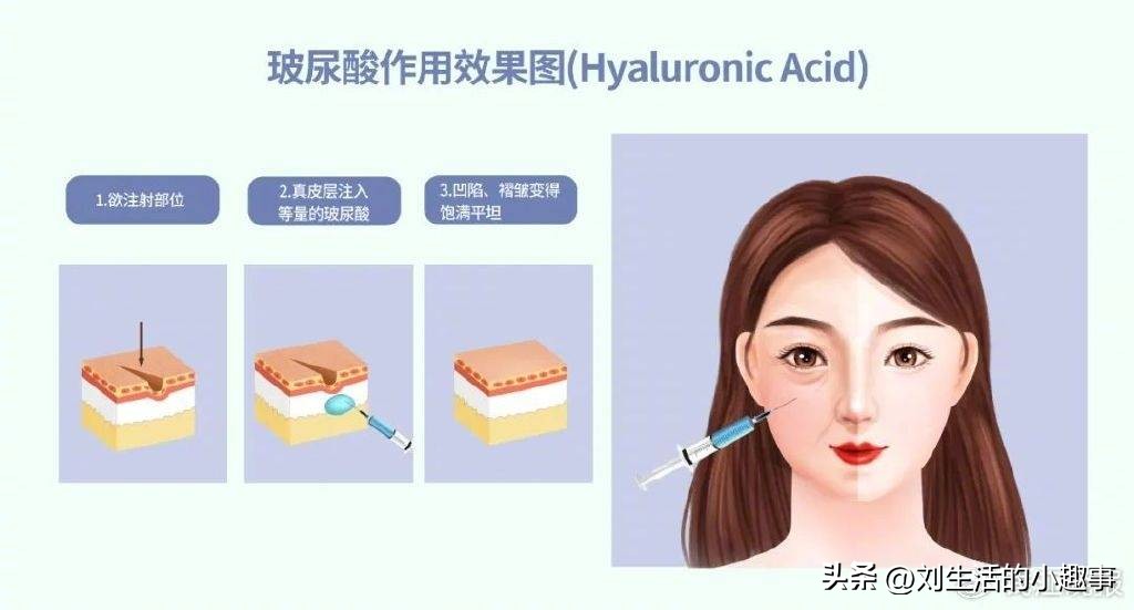 网红丰臀手术死亡,隆臀手术死亡的女子