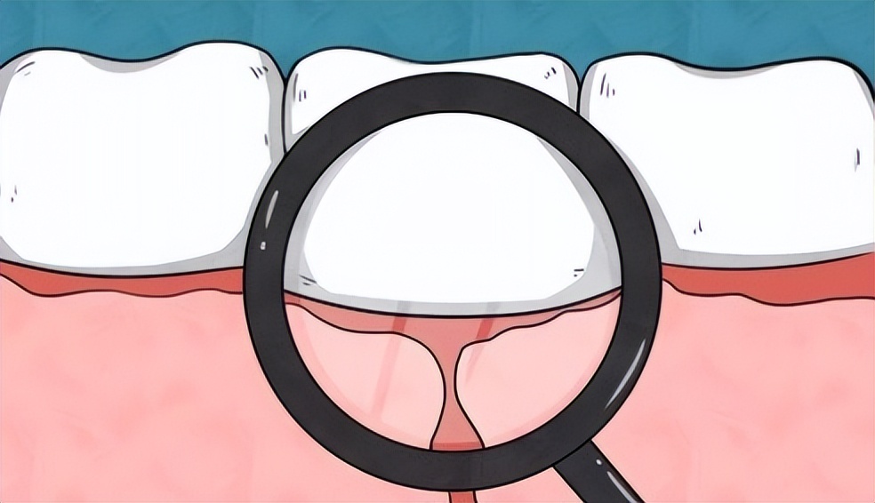 飞利浦儿童电动牙刷无蓝牙版,无盒飞利浦电动牙刷