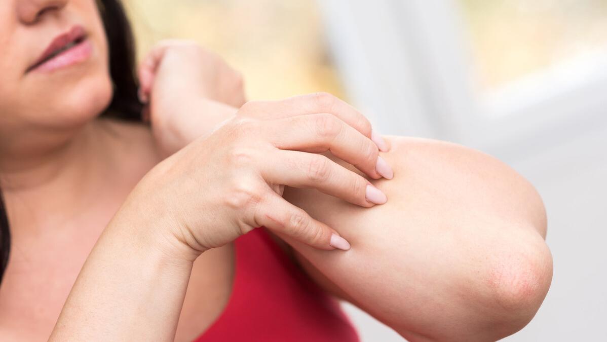 麻疹出不透的危害,麻疹和荨麻疹有什么危害