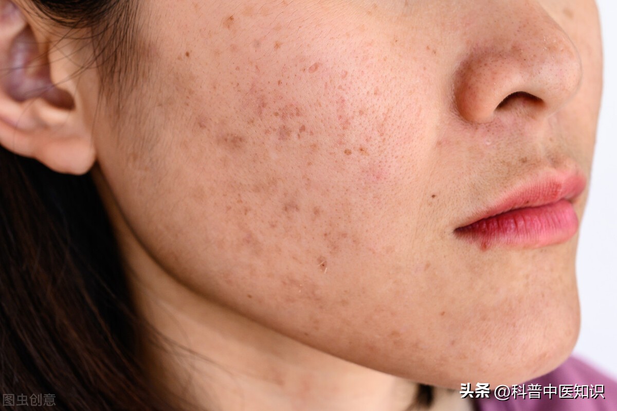 脸上有斑暗黄中医怎么调理,中药调理褐斑一般多久能见效