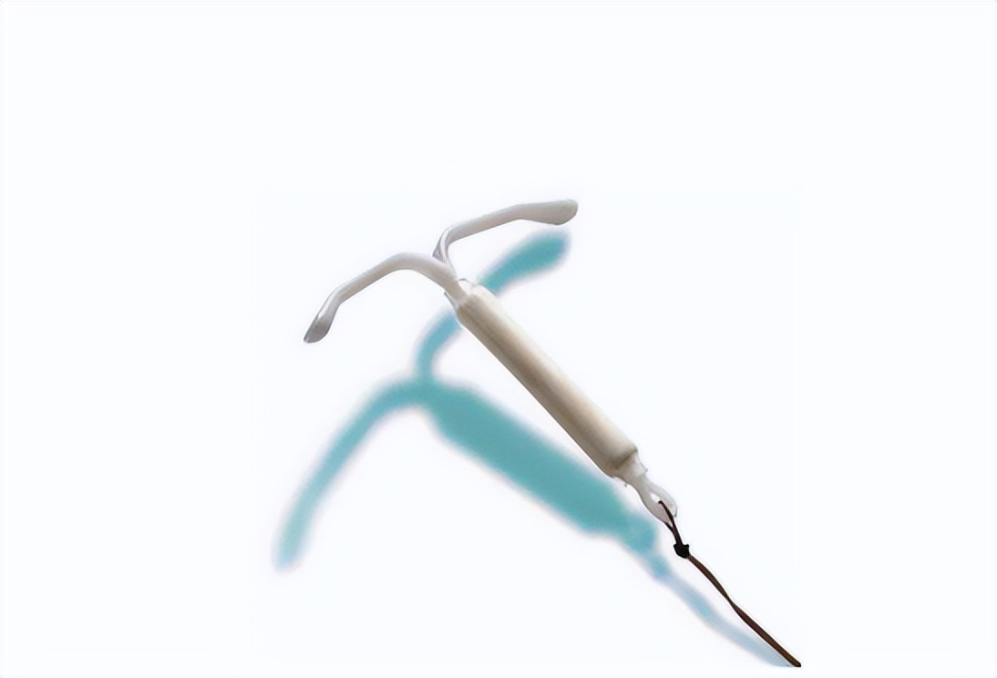 子宫腺肌症上了曼月乐环就可以治好吗？这些副作用要知晓，很重要