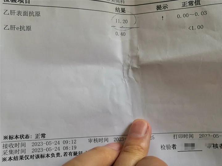 干扰素派格宾,派格宾干扰素135和180的区别