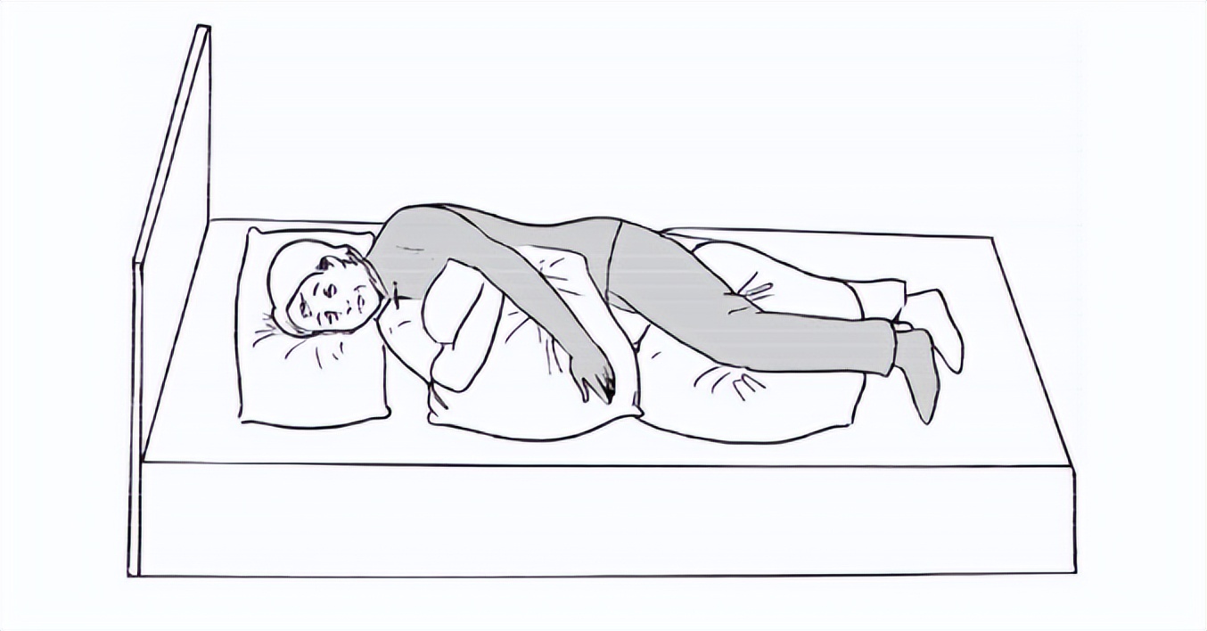 卒中病人如何自救,卒中患者需要做哪些检查