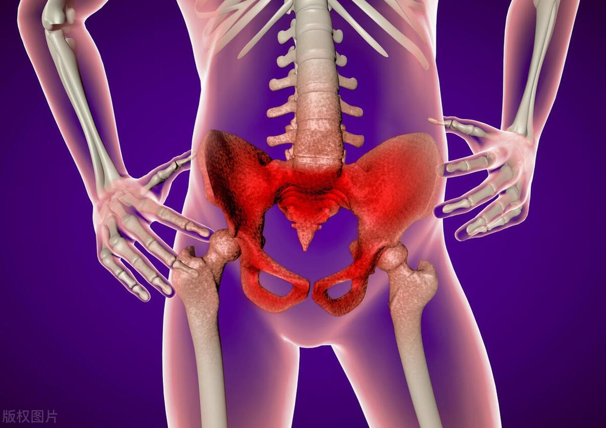 怎么改善骨盆前倾和翘臀,骨盆前倾与翘臀的区别