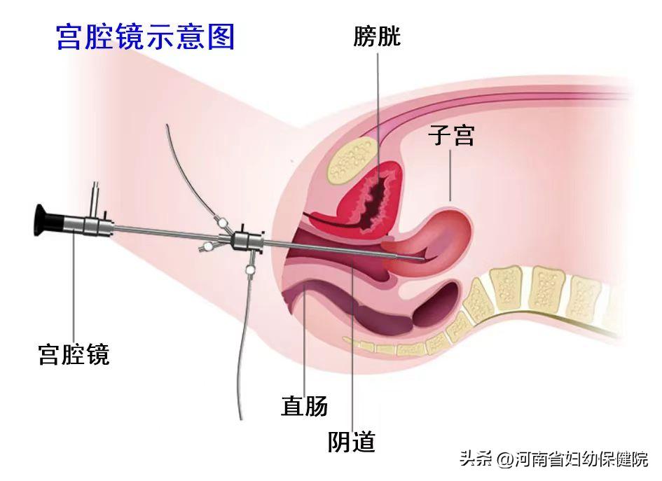 孩子有几种情况赶紧就医,家中有女孩的家长注意什么