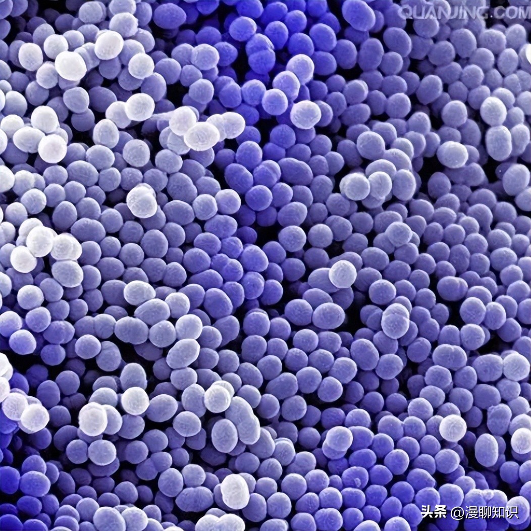 牦牛是高山地区牛的独特品种，肉质鲜嫩，但却饱受葡萄球菌的侵害