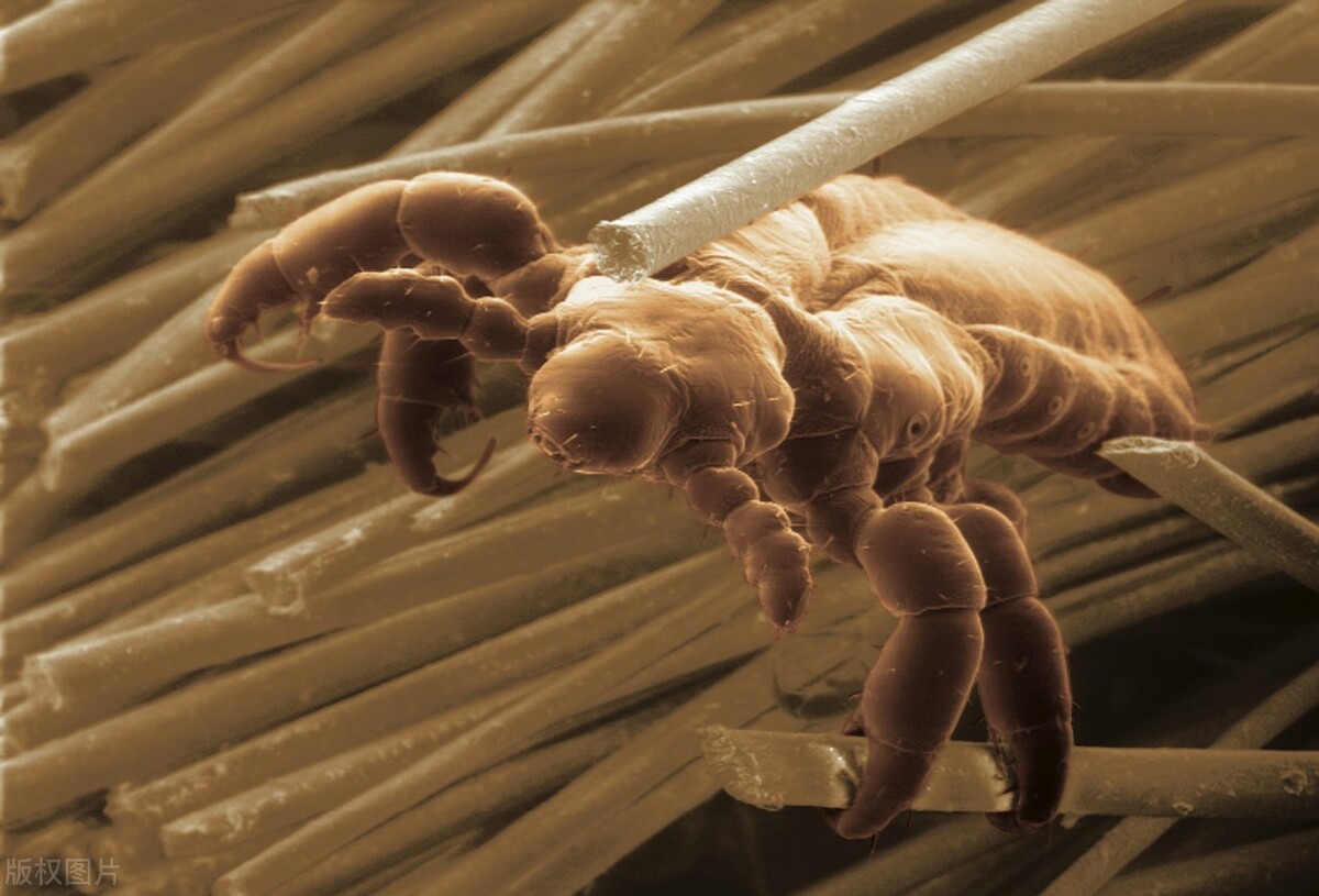 阴虱传播途径有3个，很多人都中招了！做好2点预防，希望你知道