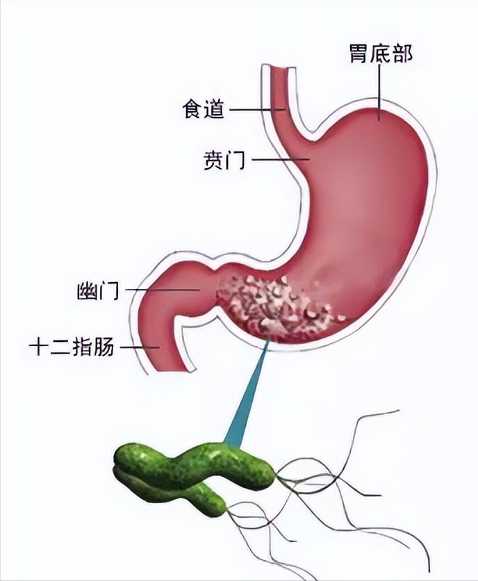 乙肝患者血小板低怎样治疗,乙肝患者血小板低怎么治疗