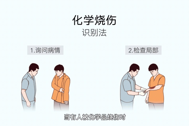 19岁女孩重度烧伤有生命危险吗,7岁小女孩被火烧伤