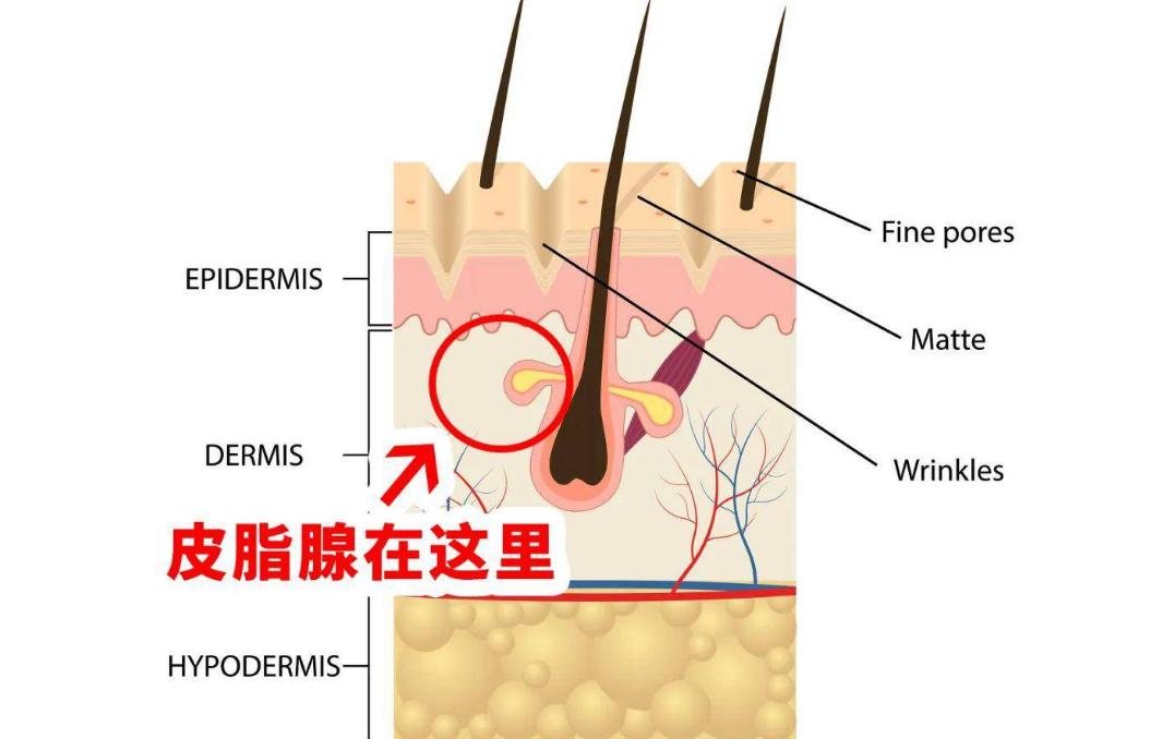 头皮总是长疙瘩或脓包是什么原因,头皮反复长疖肿起脓包