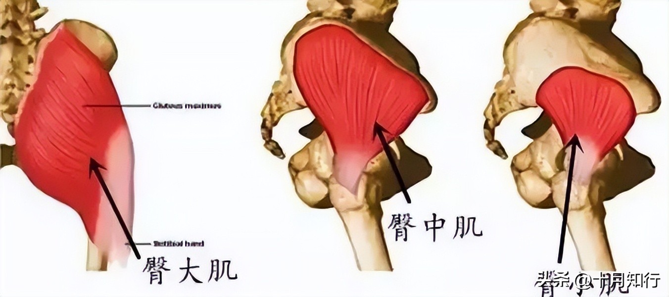 臀部下垂两侧凹陷怎样能提升臀线,怎样改善臀部两侧凹陷和提臀