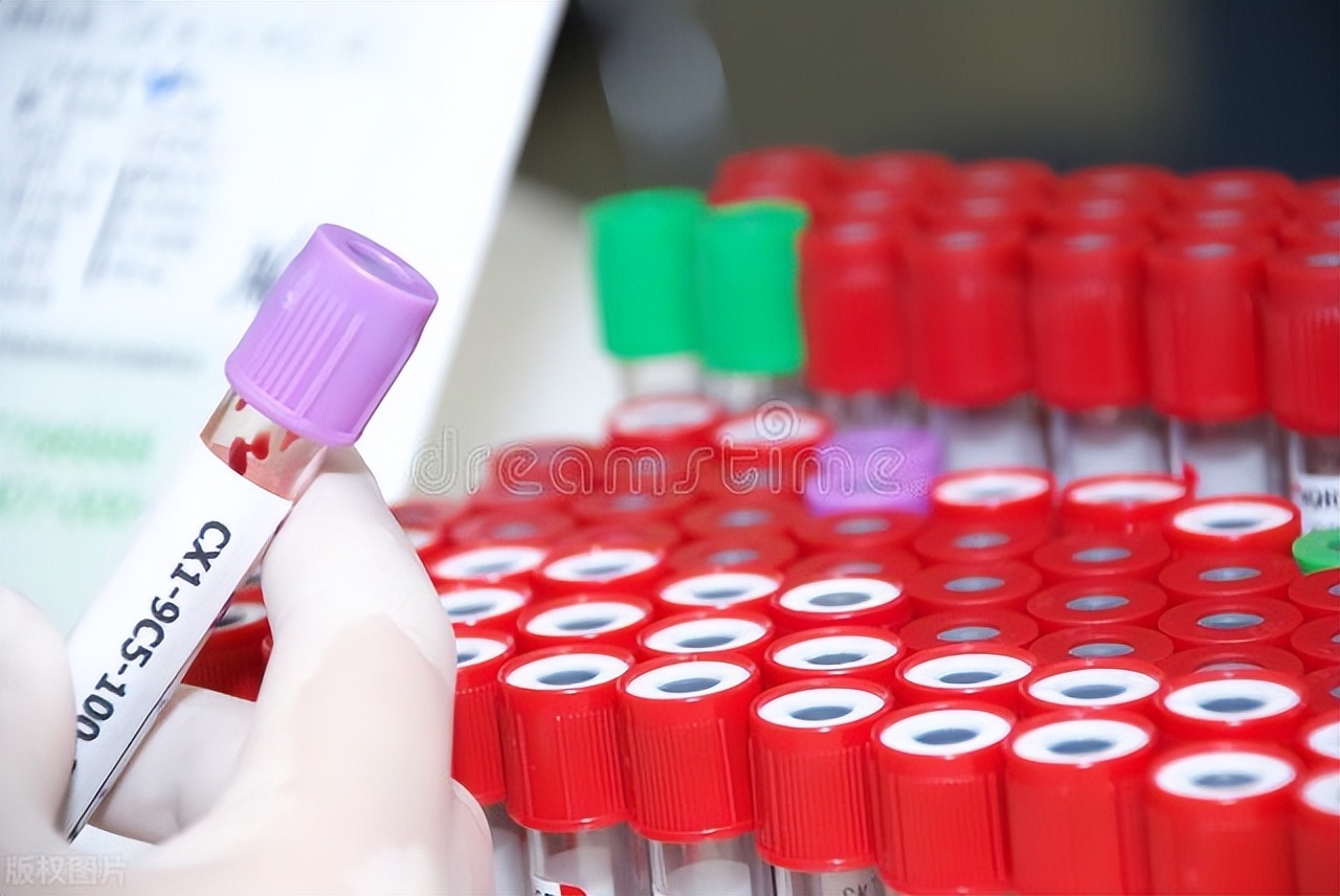 检查出贫血但身体没有症状,每次体检都是轻度贫血是怎么回事