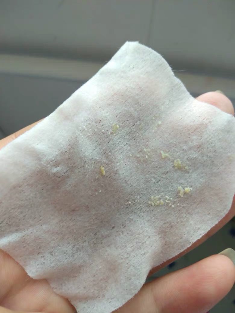 上完粉底液鼻子上有白点,涂粉底液后毛孔有白点点