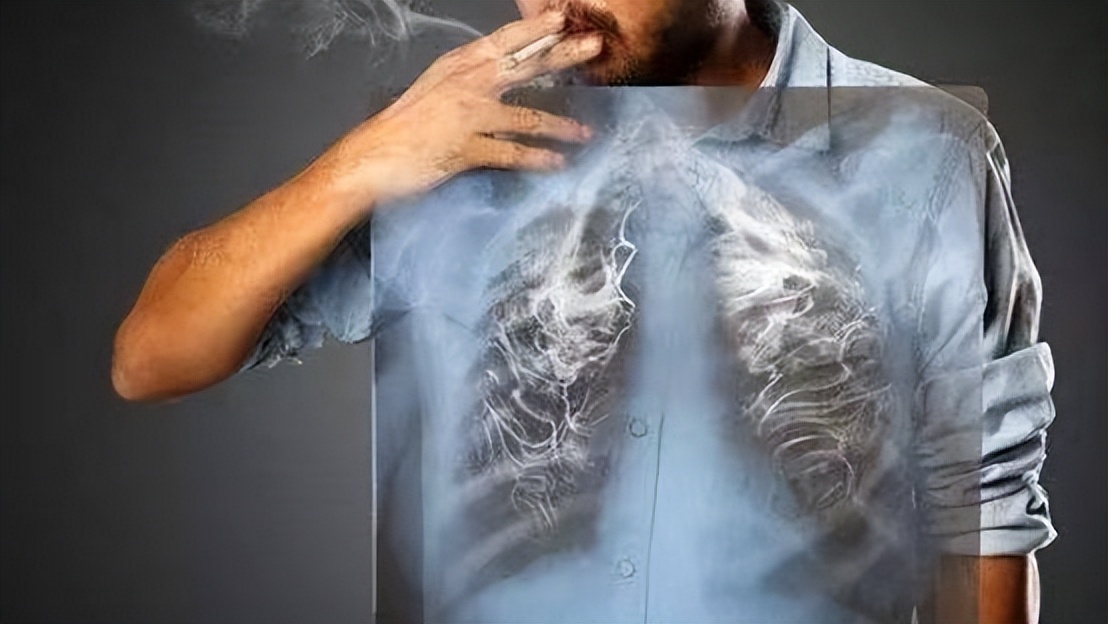 肩膀痛连着胳膊的肌肉痛是肺癌吗,肺癌晚期肩膀疼得厉害是怎么回事