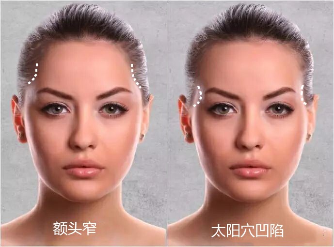 有颧骨的人怎么会显的好看,高颧骨是显老还是显年轻