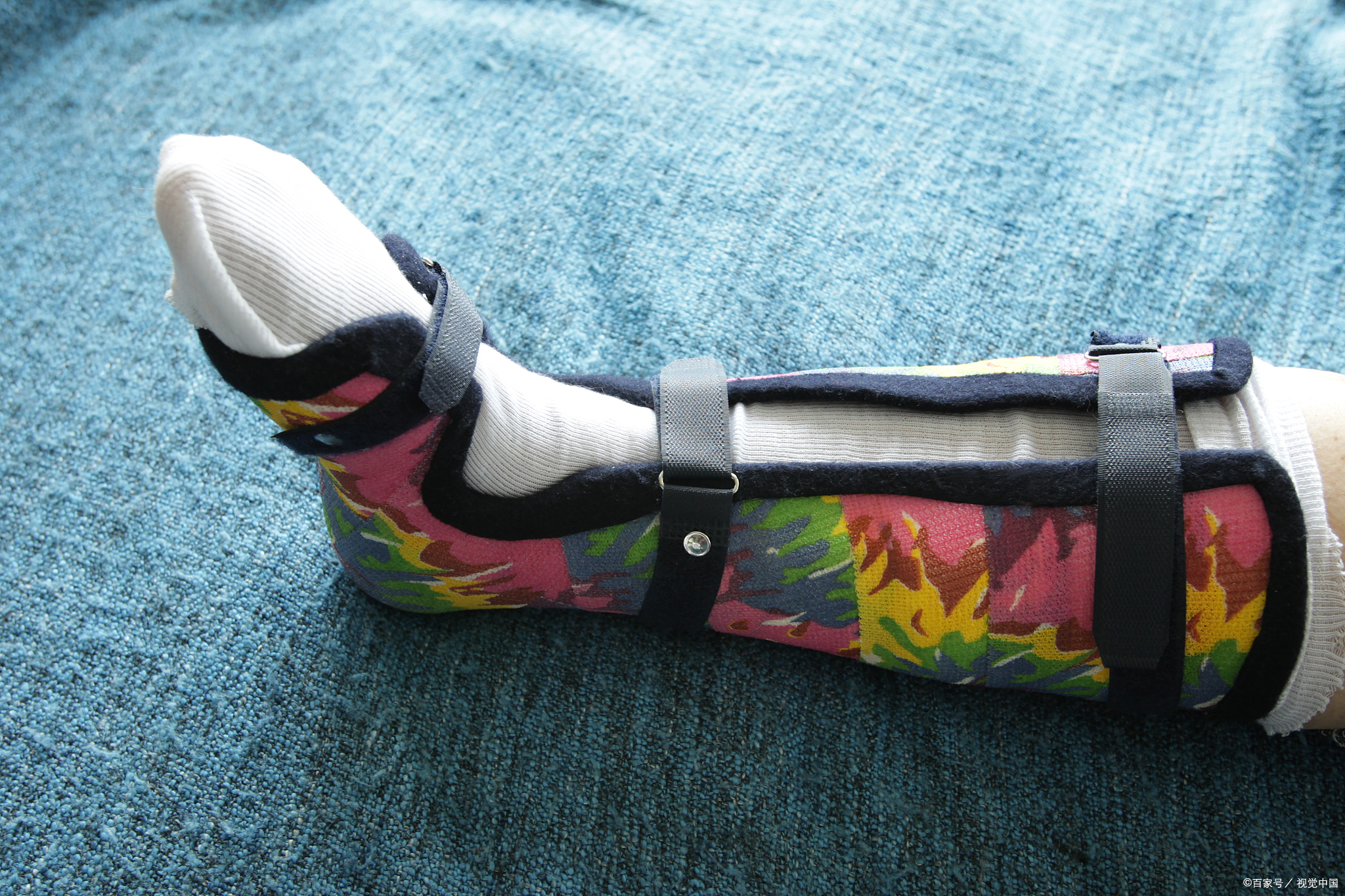 骨折病人康复训练的原则,骨折康复训练最好的方法