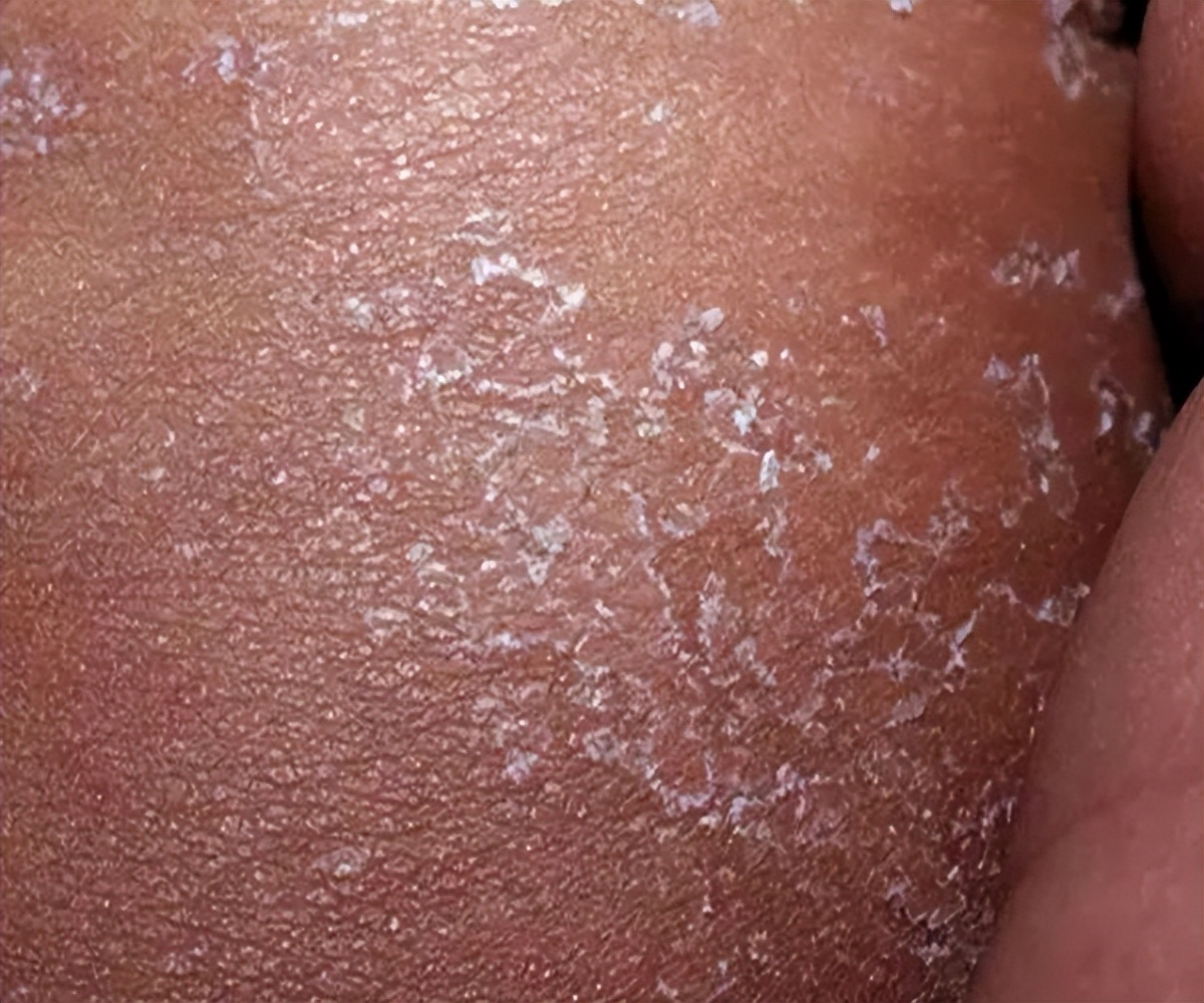 小儿舌头的各种症状如何解决,儿童舌头红色颗粒状怎么治疗