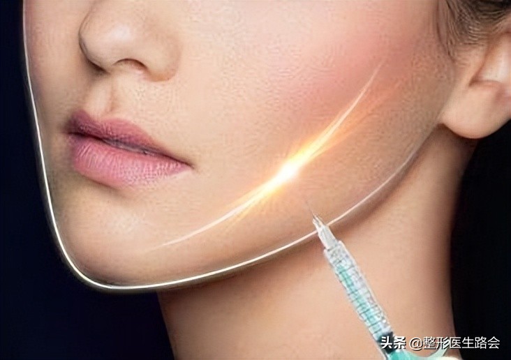 除皱针十问十答,去皱针10问