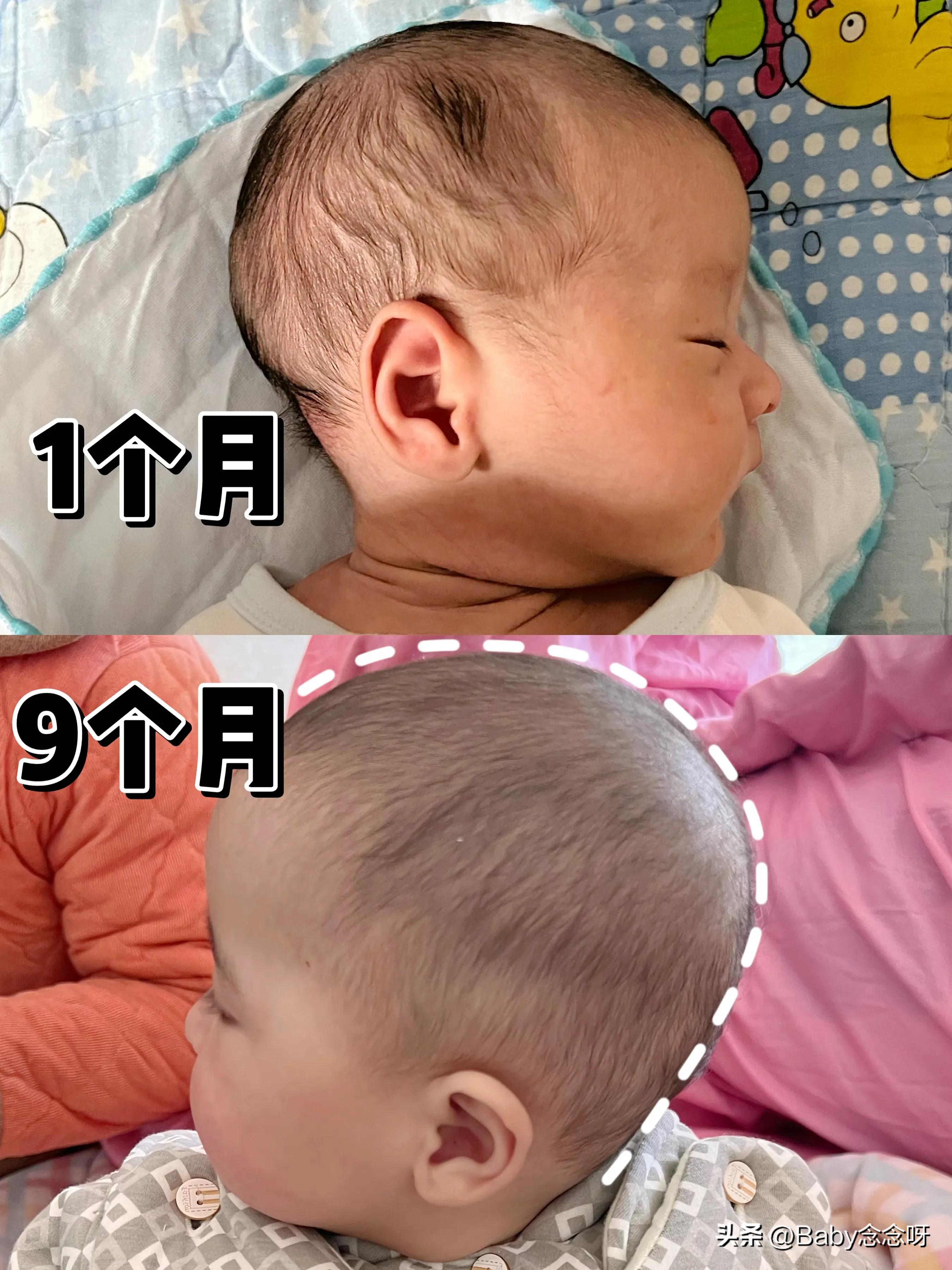 宝宝舟状头应该怎么睡能睡出圆头,手把手教五个月宝宝入睡