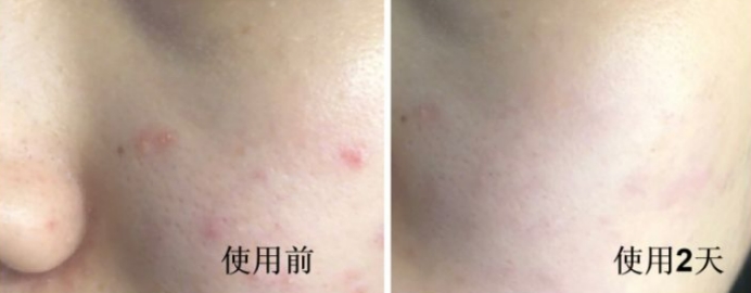 孕期补水保湿水乳推荐排名第一,孕期爆款水乳红黑榜