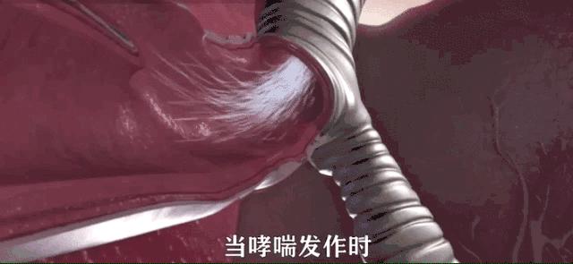 哮喘临床研究动态图表,哮喘国际最新研究成果