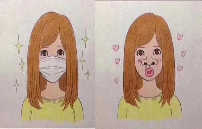 下巴短和后缩怎么变美,下巴后缩怎么矫正嘴尖