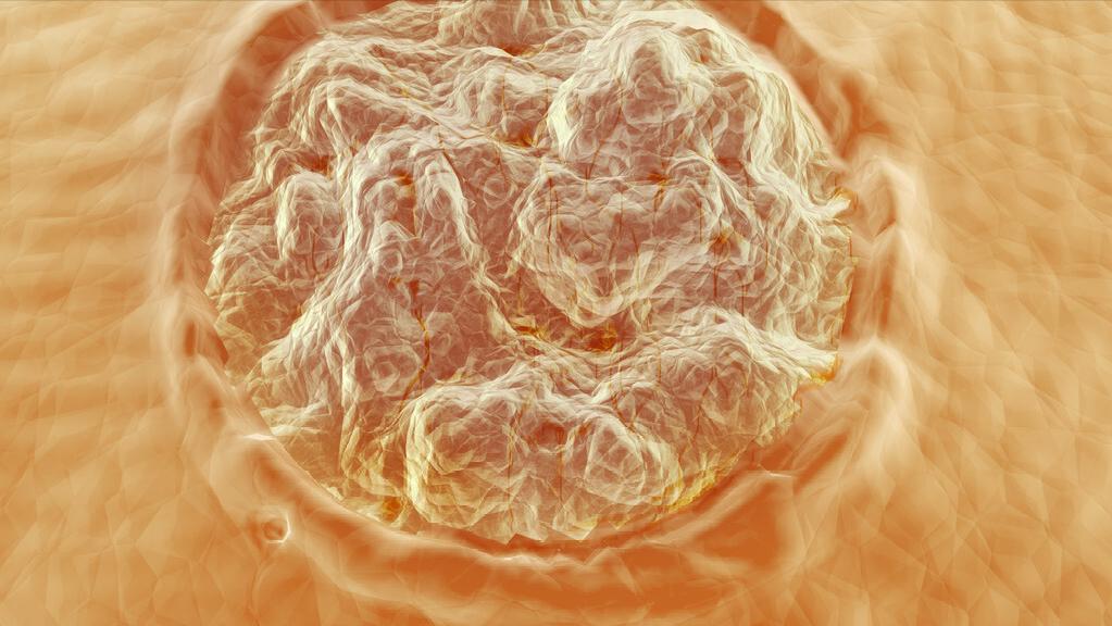 治疗hpv病毒中药方,中医治疗hpv病毒感染的方子