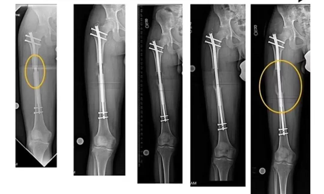 最科学的增高方法,如何增高最有效的方法20厘米
