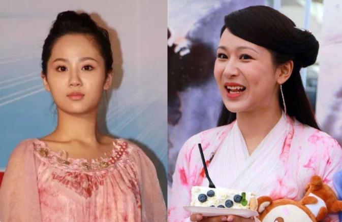 盘点整容失败惨不忍睹的30位女星,那些整容整失败的女明星