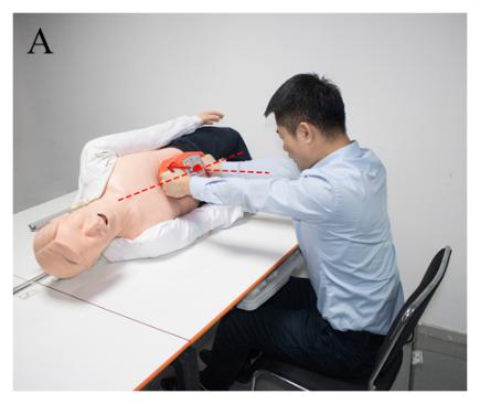 腹部提压心肺复苏术有用吗,腹部提压心肺复苏和胸外心脏按压