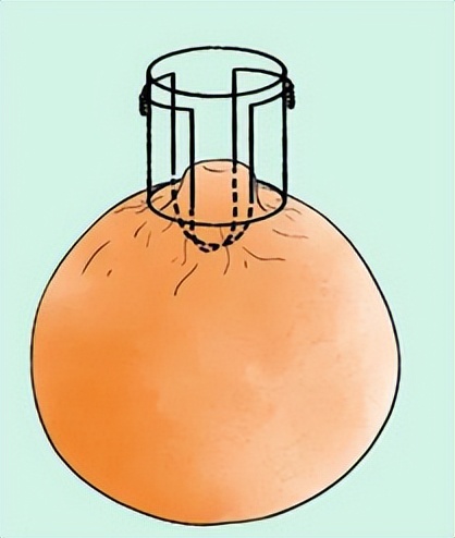 胸部长的褐色小点是什么,女生胸部上长了白色小点点