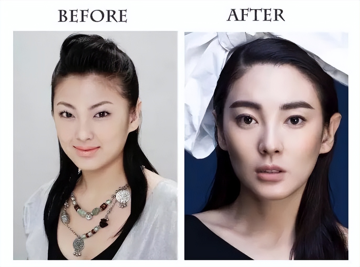 最近哪个明星割双眼皮前后对比,明星一般都做什么样的双眼皮