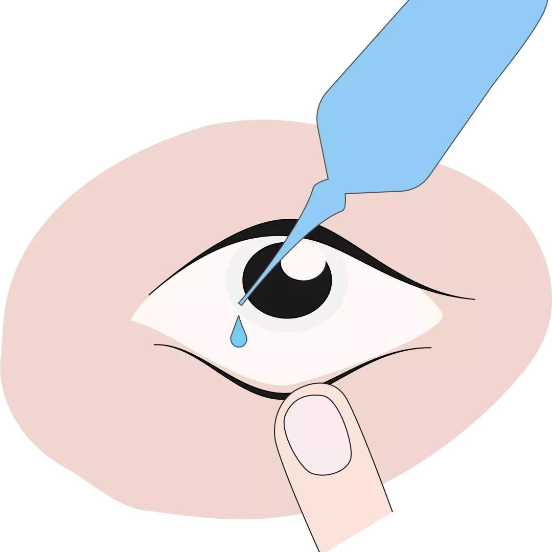 阿托品缓解眼睛疲劳吗,含有阿托品眼药水推荐