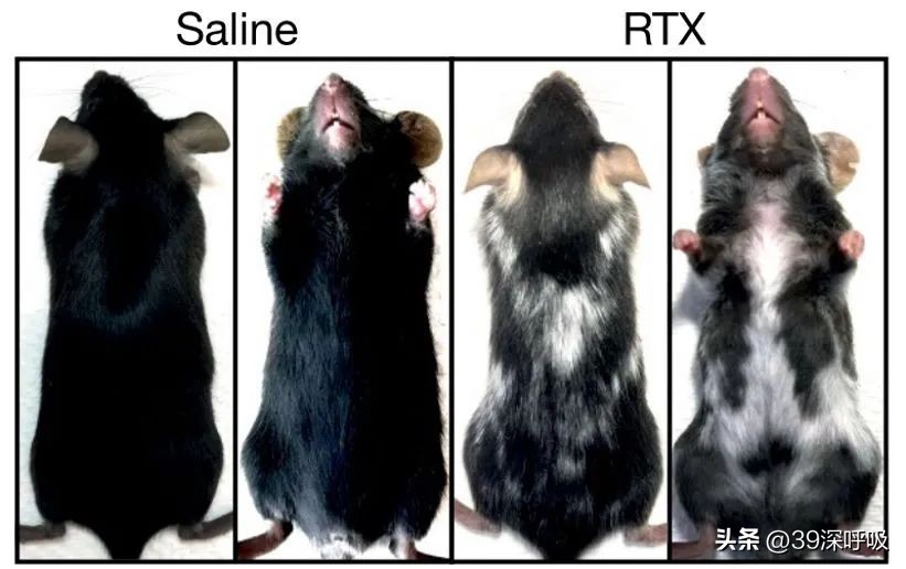治疗白发转黑发的骗局,白发15天转黑发靠谱吗