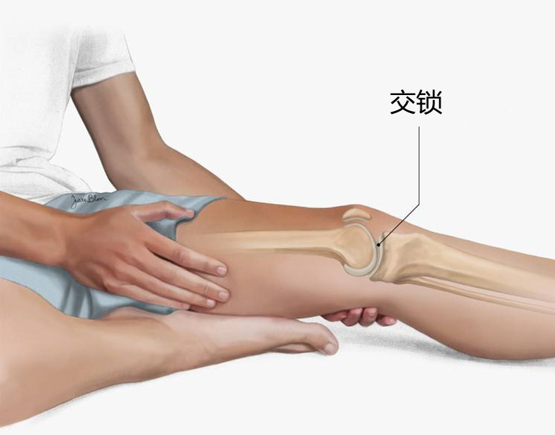 膝盖核磁共振半月板损伤怎么办,膝盖疼痛核磁共振