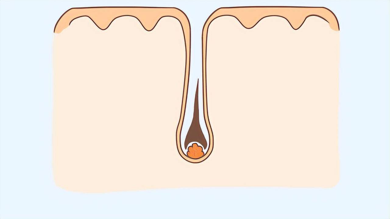 阴毛有什么用？要不要刮掉？由黑变白，意味着什么？男女都需了解