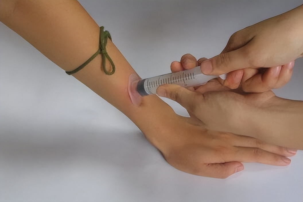 在农村被毒蛇咬了怎么处理,野外毒蛇咬伤怎样自救