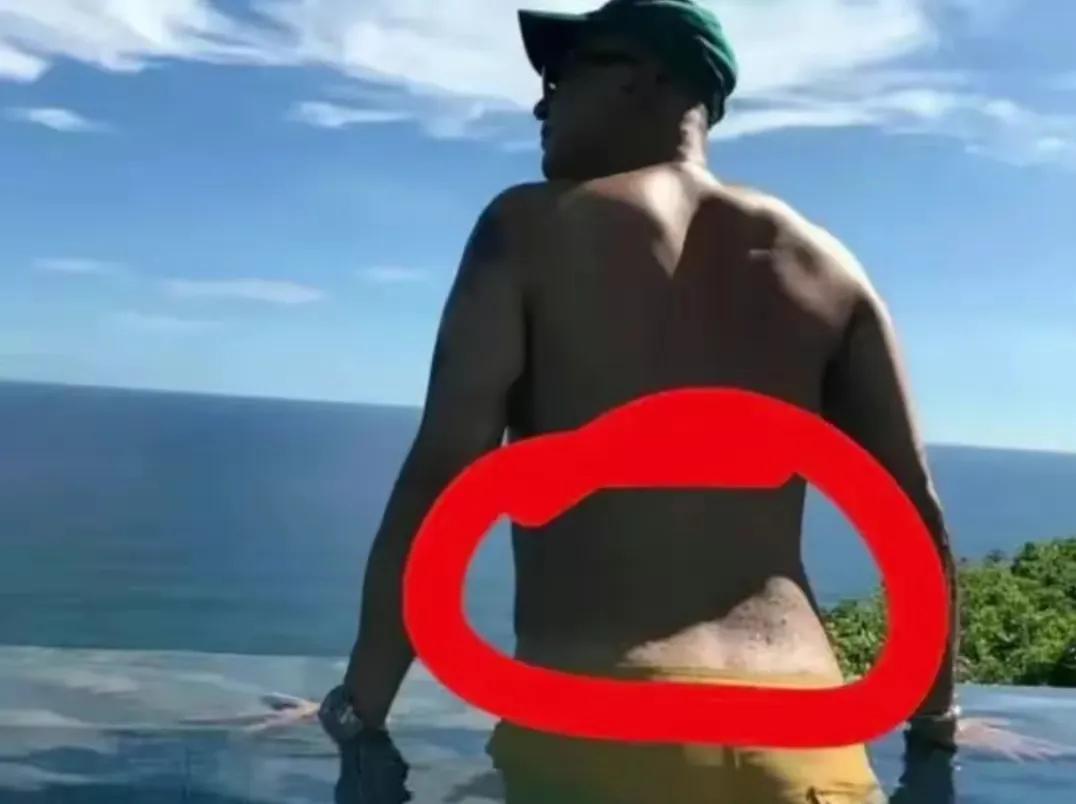 皮肤科董医生门诊分享,皮肤科专家董医生