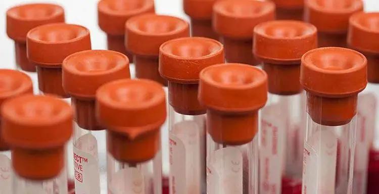 血糖糖化控制在6,血糖控制在多少糖化才会达标