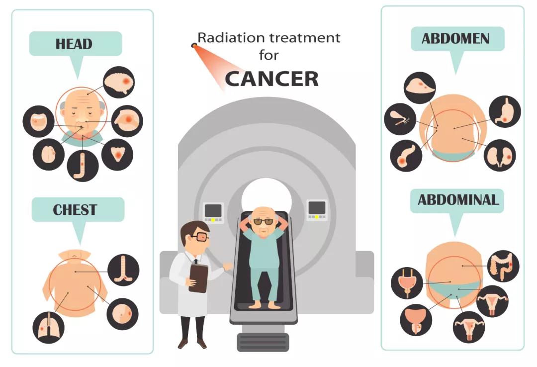 接受放疗的人会有辐射吗,接受放疗的人对他人有影响吗