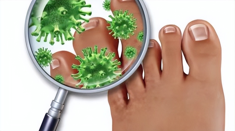 真菌感染皮肤病怎么预防,足部真菌感染导致肺部真菌感染